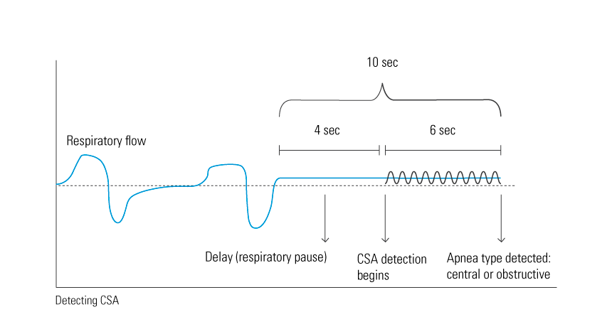 CSA-graph