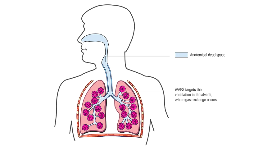 Targeting-alveolar-ventilation